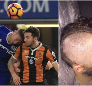 Ryan Mason tuvo que ser operado de la cabeza tras sufrir una fractura craneal Ryan Mason tuvo que ser operado de la cabeza tras sufrir una fractura craneal
