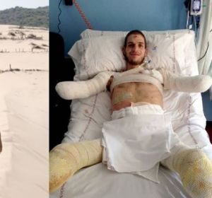 El joven Davide antes y después de ser amputado El joven Davide antes y después de ser amputado
