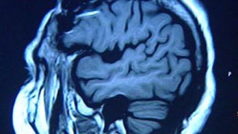 El cerebro influye en las creencias