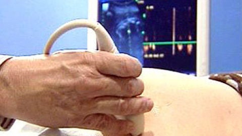 C&eacute;lulas madre contra la infertilidad