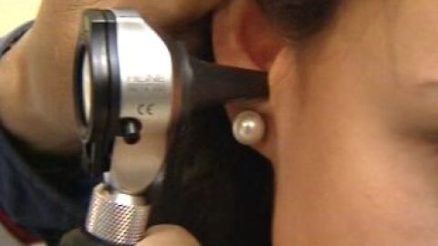 La huella dactilar del o&iacute;do