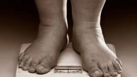 El niño pesa más de 140 kilos El niño pesa más de 140 kilos