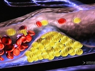 Investigadores de la UMH participan en un estudio que revela que los niveles de colesterol aumentan en países con ingresos bajos y medios Investigadores de la UMH participan en un estudio que revela que los niveles de colesterol aumentan en países con ingresos bajos y medios