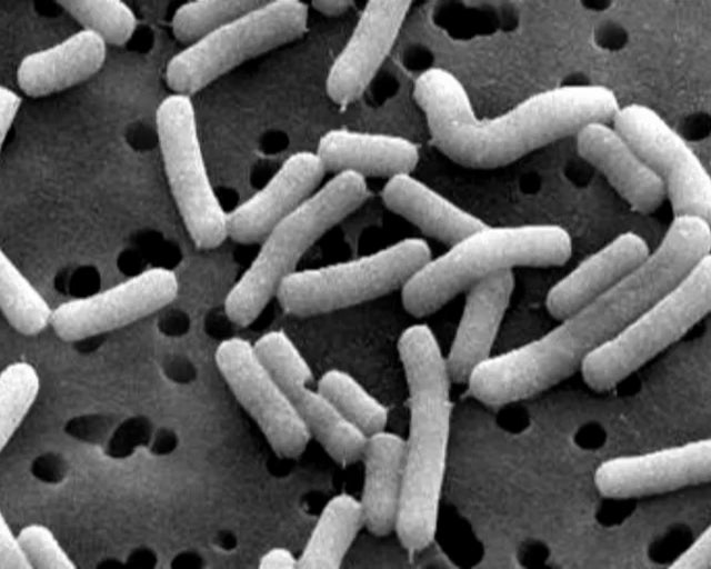 Azul y Verde: Bacterias que detectan minas Azul y Verde: Bacterias que detectan minas