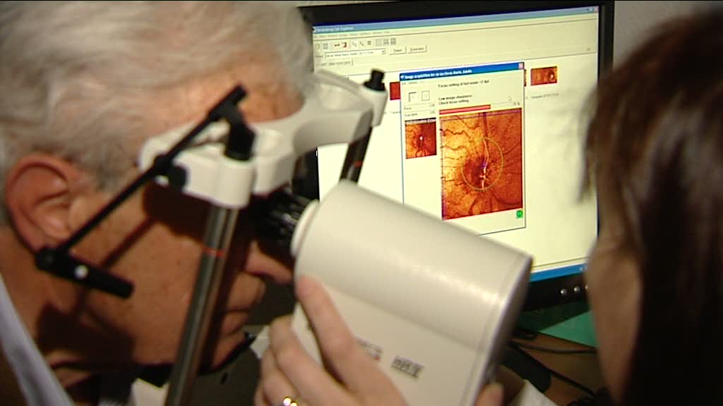 El Glaucoma El Glaucoma