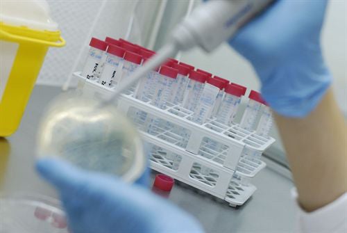 Usan el líquido cefalorraquídeo para el diagnóstico precoz de tumores cerebrales Usan el líquido cefalorraquídeo para el diagnóstico precoz de tumores cerebrales