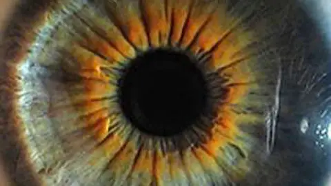 El iris de un ojo El iris de un ojo