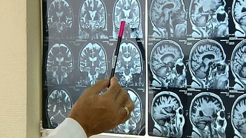 Radiograf&iacute;as del cerebro