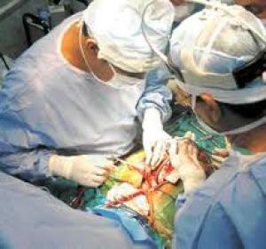 Barnard hace el primer trasplante de corazón Barnard hace el primer trasplante de corazón