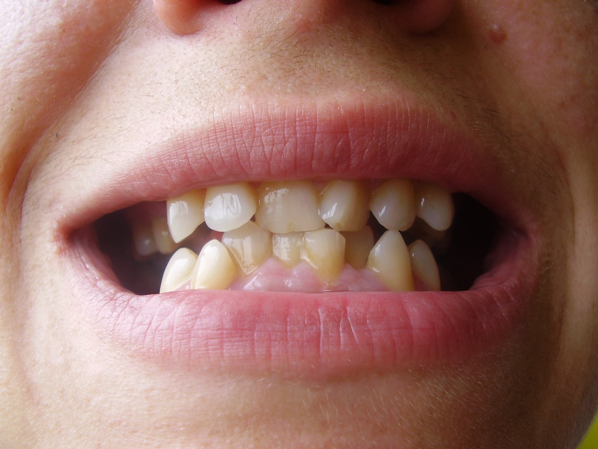 La regeneración de los dientes gracias a los peces La regeneración de los dientes gracias a los peces