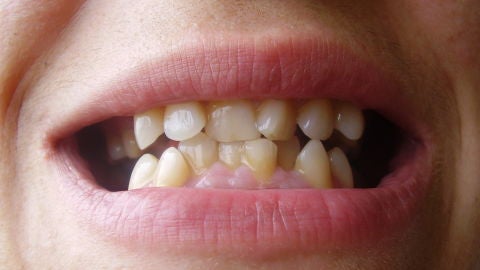 Dientes