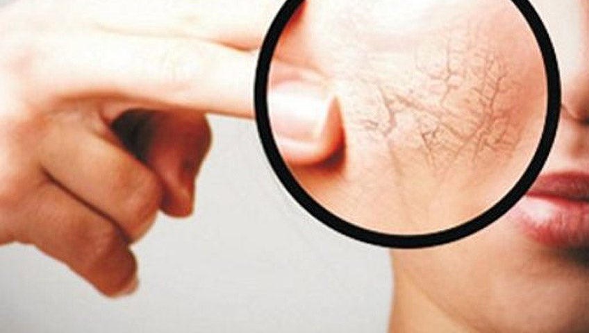 Unos 80 lucenses padecen esclerodermia Unos 80 lucenses padecen esclerodermia