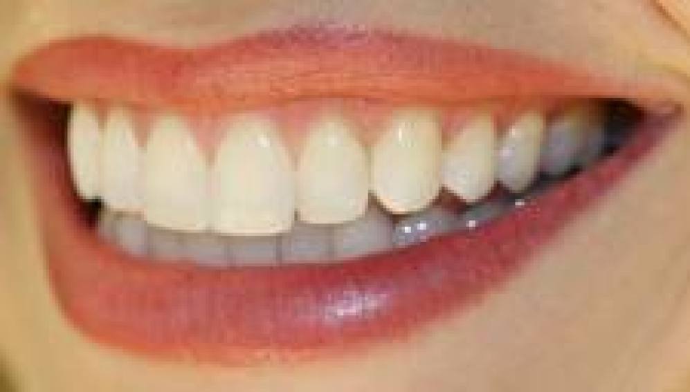 dientes blancos