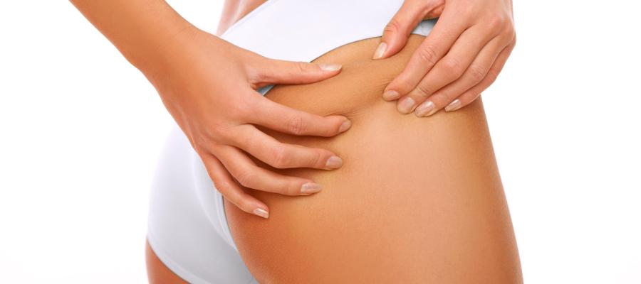 Acaba con la celulitis Acaba con la celulitis