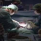 Transplante de riñón Transplante de riñón