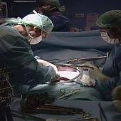 Transplante de riñón
