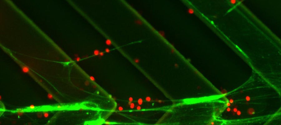 Células cancerígenas Células cancerígenas