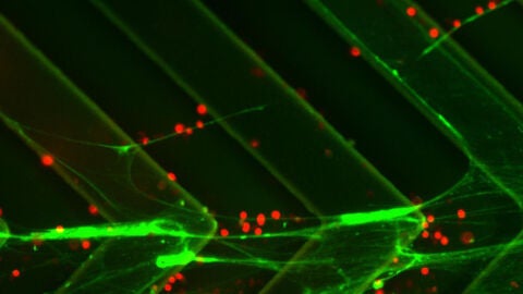 C&eacute;lulas cancer&iacute;genas 