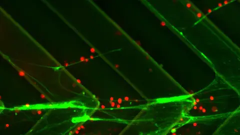 Células cancerígenas Células cancerígenas