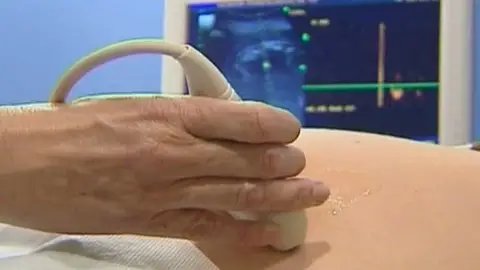 Una mujer embarazada en el ginecólogo Una mujer embarazada en el ginecólogo