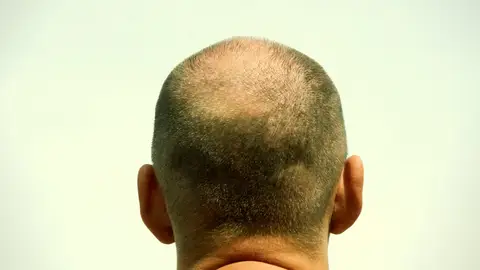 “Todo cambió cuando me hicieron una foto por detrás" “Todo cambió cuando me hicieron una foto por detrás"