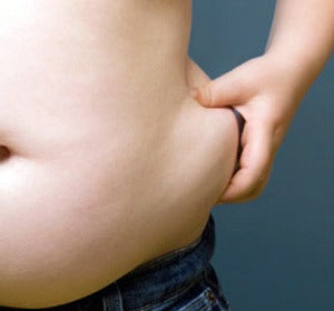 Sobrepeso en la zona abdominal Sobrepeso en la zona abdominal
