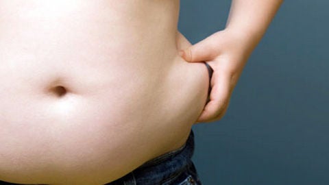 Sobrepeso en la zona abdominal