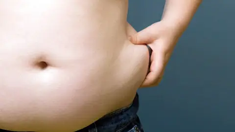 Sobrepeso en la zona abdominal Sobrepeso en la zona abdominal