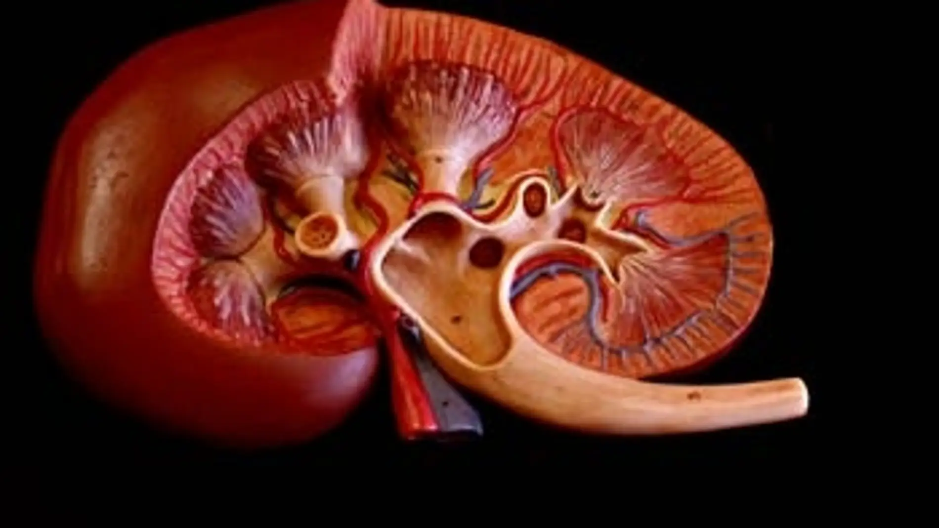 Imagen de un riñón