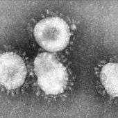 Imagen del coronavirus en el microscopio