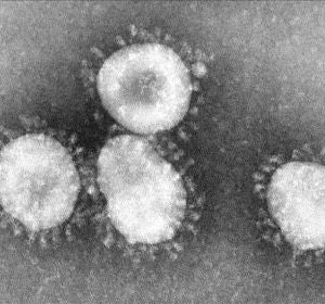 Imagen del coronavirus en el microscopio Imagen del coronavirus en el microscopio