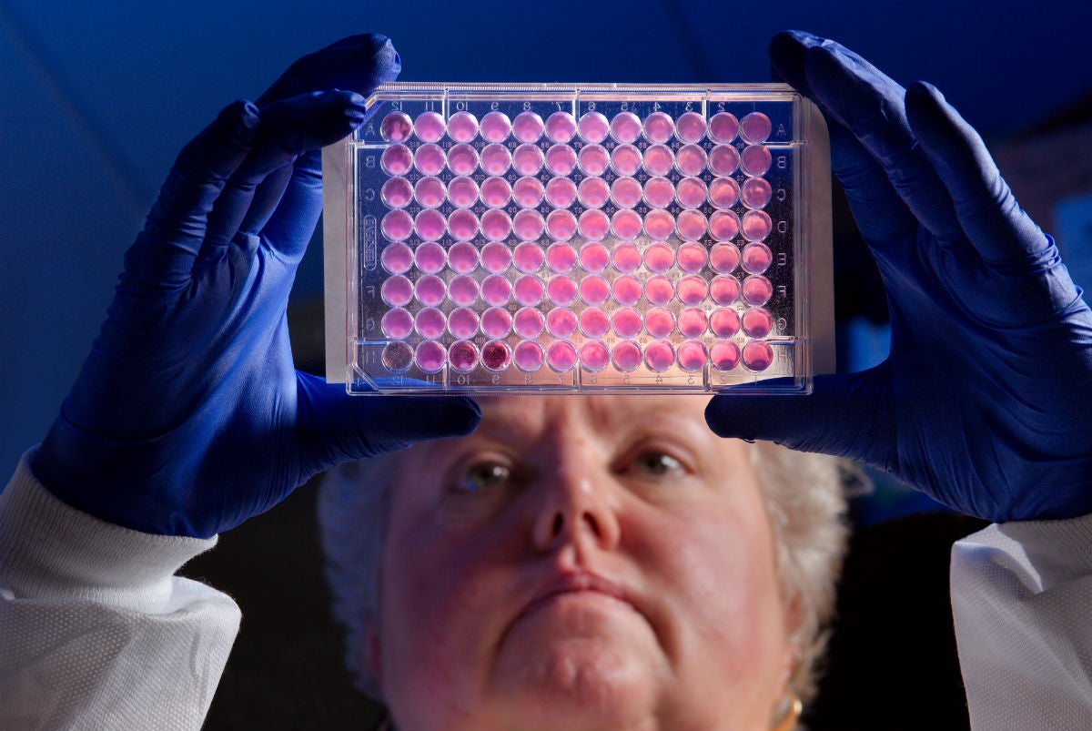 Las superbacterias serán la principal causa de muerte en el mundo por delante del cáncer en el año 2050 Las superbacterias serán la principal causa de muerte en el mundo por delante del cáncer en el año 2050