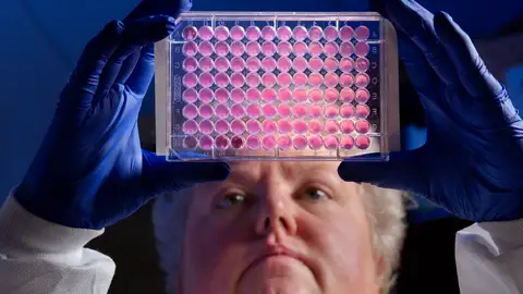 Superbacterias Superbacterias