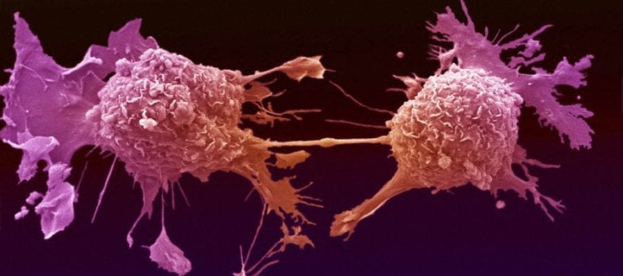 Células de cáncer de pulmón Células de cáncer de pulmón