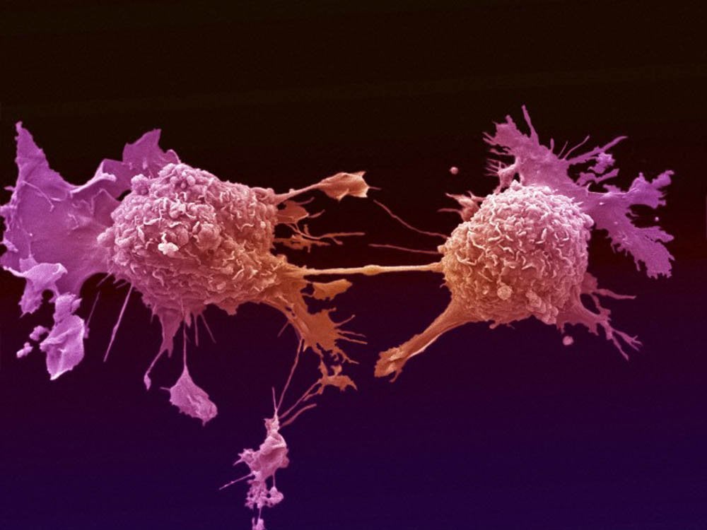 La Brújula de la ciencia: ¿Cómo funciona el sistema inmune y cómo pelea contra el cáncer? episode artwork