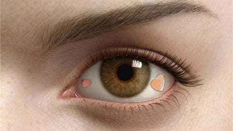 Joya en el globo ocular