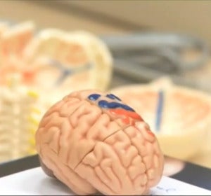 Cerebro Cerebro