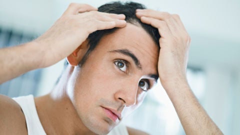 Implantes de pelo antiguos