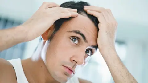 Implantes de pelo antiguos Implantes de pelo antiguos