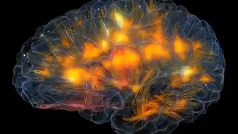 El creador de Second Life escanea el cerebro de su mujer con realidad virtual El creador de Second Life escanea el cerebro de su mujer con realidad virtual