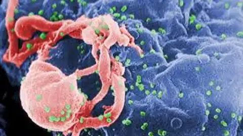 El virus del sida El virus del sida
