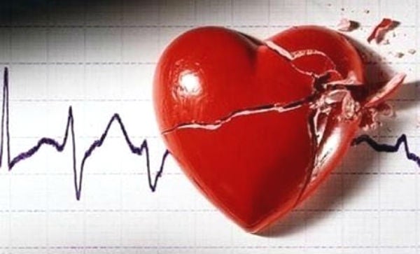 La consulta médica: La muerte súbita en el deporte La consulta médica: La muerte súbita en el deporte