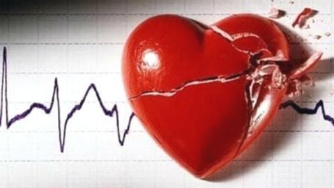 La miocardiopat&iacute;a hipertr&oacute;fica, una de las principales causas de muerte s&uacute;bita.