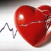 La miocardiopatía hipertrófica, una de las principales causas de muerte súbita.