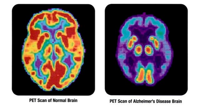 Hallan un gen que agrava los efectos de la polución en el neurodesarrollo infantil Hallan un gen que agrava los efectos de la polución en el neurodesarrollo infantil