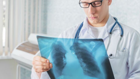 Un m&eacute;dico mira una radiograf&iacute;a de un pac