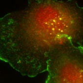 Células tumorales humanas de cáncer de m
