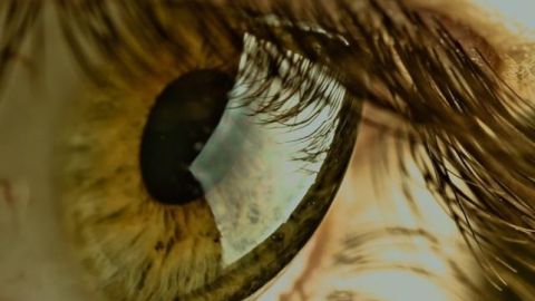 C&eacute;lulas madre de la pulpa dental pueden transformarse para tratar cicatrices en la c&oacute;rnea