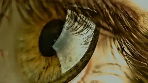 Células madre de la pulpa dental pueden transformarse para tratar cicatrices en la córnea Células madre de la pulpa dental pueden transformarse para tratar cicatrices en la córnea