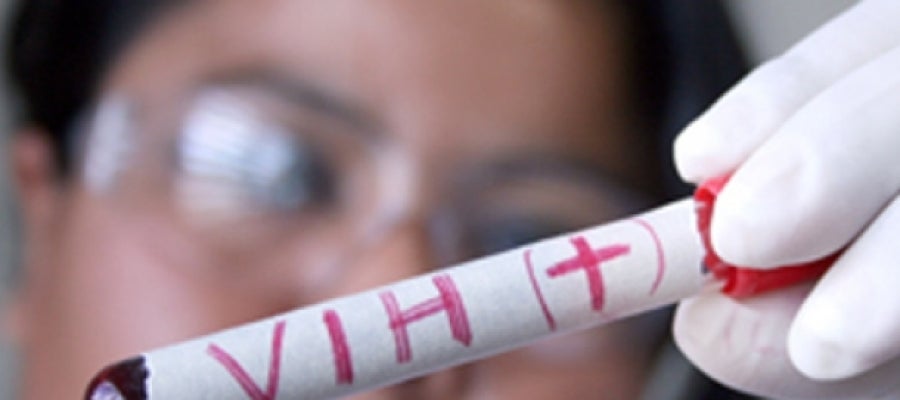 Muestra de VIH en un laboratorio Muestra de VIH en un laboratorio